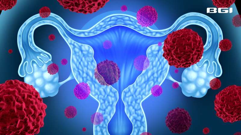 BGI Genomics Targetable Ovarian Cancer Variants RAD51D Credit: BGI Genomics