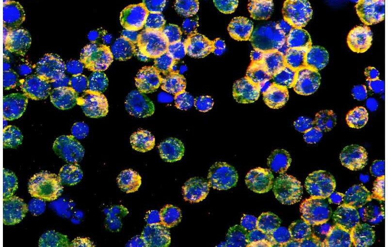 Discovery of new mechanism explains how ovarian cancer disables immune cells